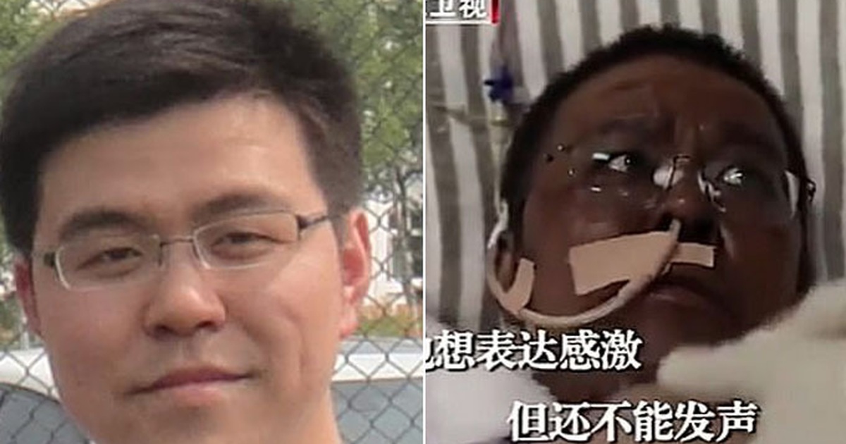 Bác sĩ Trung Quốc bị đổi màu da vì Covid-19 qua đời