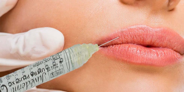Những điều cần biết để hiểu đúng về thẩm mỹ không "dao kéo" - 3 Mỗi mũi tiêm Juvederm® VolumaTM có tác dụng kéo dài 2 năm, không gây đau đớn và không để lại biến chứng.