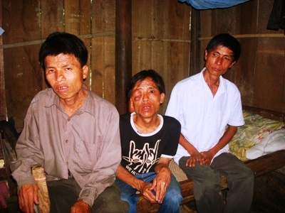 Hai anh em mồ côi vật lộn với chất độc quái ác - 1