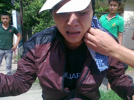 Bị phát hiện, tên trộm dùng dao chống trả người truy đuổi - 1