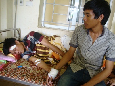 3 tên côn đồ chém dã man tổ bảo vệ khu nhiệt điện Vũng Áng  - 2