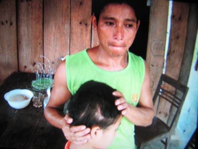 Vết thương của bé trai bị bò húc bị nhiễm trùng - 2