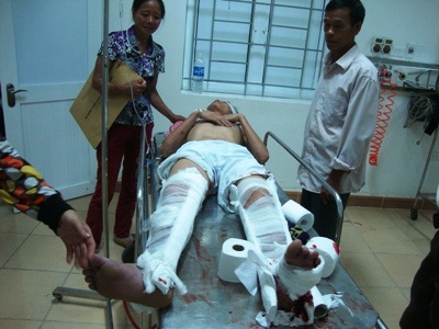 Vụ tai nạn xe khách thảm khốc: Xe cố chạy sau khi bị hỏng? - 2