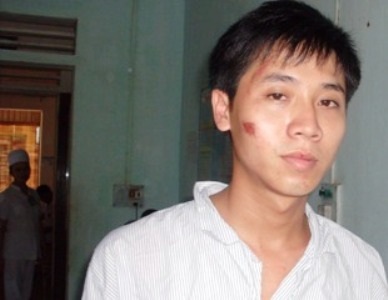 Phó Bí thư đoàn xã bị đánh tại đám cưới - 1