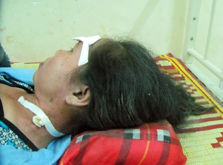 Lời kể nạn nhân vụ sập sảnh tòa khách sạn Sailing Tower - 2