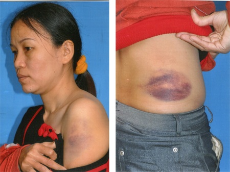 Nữ bác sĩ bị kẻ lạ hành hung trong ca trực - 1