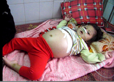 Tình cảnh hiểm nghèo của bé gái người dân tộc Chứt - 1 Tình cảnh hiểm nghèo của bé gái người dân tộc Chứt - 1