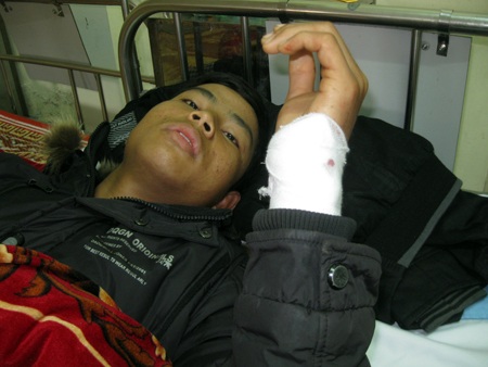 Bị chém đứt gân tay vì từ chối đánh bài ăn tiền