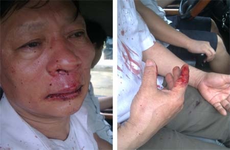 Vụ con nợ đánh chủ nợ: Chủ nợ bị tố lật lọng trong chuyện tiền bạc - 1 Vụ con nợ đánh chủ nợ: Chủ nợ bị tố lật lọng trong chuyện tiền bạc - 1