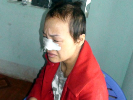 Vụ cắt tóc, lột quần tình địch: Khởi tố vợ, kỷ luật chồng - 1 Vụ cắt tóc, lột quần tình địch: Khởi tố vợ, kỷ luật chồng - 1