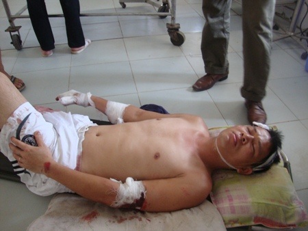 Côn đồ truy sát dã man 