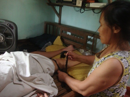 Trước khi vẽ hay nằm người mẹ đều luôn buộc hai chân với thang giường cho đỡ đau suốt 9 năm nay