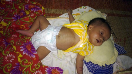  Vì bệnh nặng bé Song Ngân đã về cõi vĩnh hằng