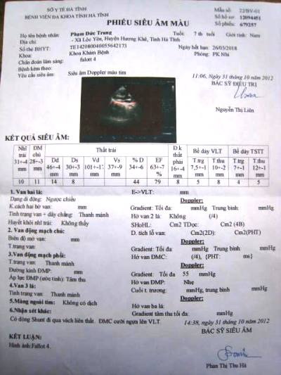 Người mẹ khóc cạn nước mắt vì thương con - 4 Người em trai bị bệnh tâm thần đã được xích chặt vào cột nhà (mặc quần xanh)