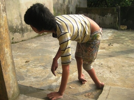 ...không thể đi lại được bình thường