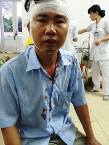 Một tài xế xe buýt bất ngờ bị chém xối xả - 1 Anh Hiếu bị chém trúng một nhát vào đầu phải khâu 10 mũi