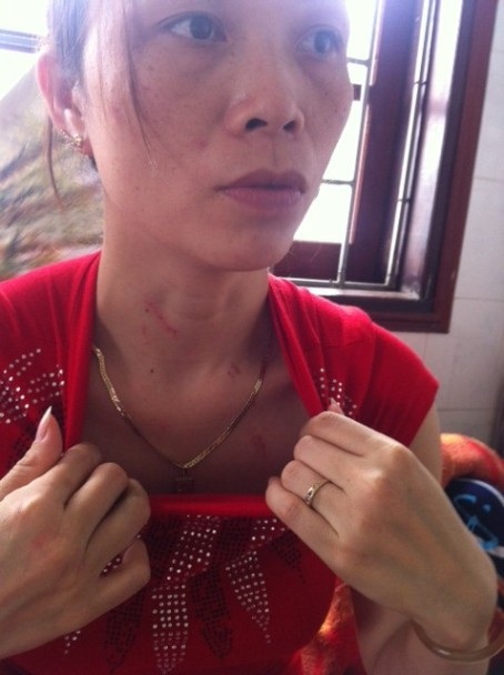 Chị Nga vào can ngăn cũng bị cha con ông Tòng đánh đập dã man