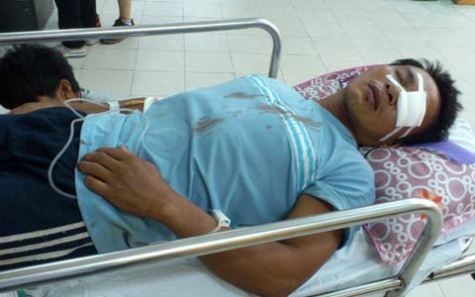 Bị tấn công trên biển, 4 ngư dân trọng thương - 1 Anh Lê Văn Dũng đang được cấp cứu tại Bệnh Viện ĐK Hà Tĩnh