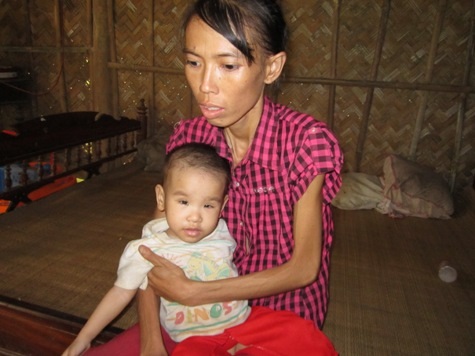 Lại bé 2 tuổi mang 2 trọng bệnh chỉ có cơm chan với nước canh - 1 Bé Minh Hằng nhỏ thó, xanh xao khi cùng lúc mang trong mình hai trọng bệnh hiểm nghèo