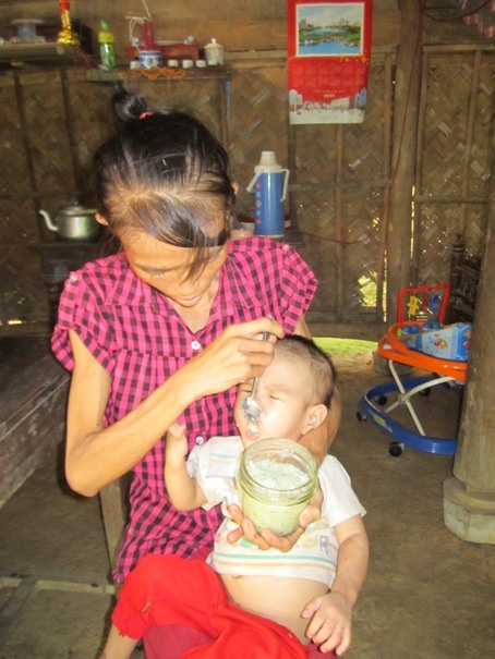 Lại bé 2 tuổi mang 2 trọng bệnh chỉ có cơm chan với nước canh - 2 Bé Minh Hằng nhỏ thó, xanh xao khi cùng lúc mang trong mình hai trọng bệnh hiểm nghèo