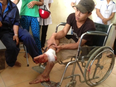 Anh Phan Văn Lĩnh bị nhiều cú đập vào lưng và một nhát chém sâu ở chân 