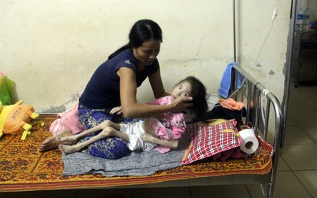 Hơn 142 triệu đồng đến với bé 12 tuổi cân nặng 4kg - 1 Bé Mai Anh đang thoi thóp sự sống