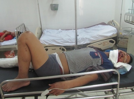 Một trong 3 nạn nhân trong vụ sập giàn giáo đang được cấp cứu tại Bệnh viện đa khoa Hà Tĩnh