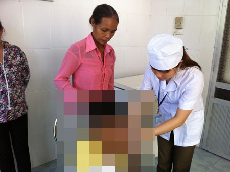 Một bệnh nhân tử vong nghi bị chó dại cắn - 1 Một nạn nhân bị chó dại cắn đang được y tá tiêm phòng dịch
