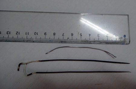 3 thanh kim loại được lấy ra ngoài, giúp cứu sống nạn nhân