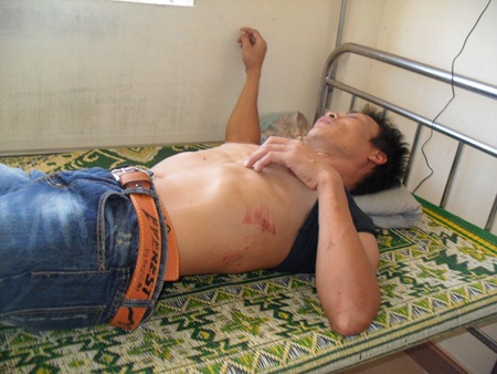 Anh Hoàng Văn Hạnh nhập viện trong tình trạng đa chấn thương