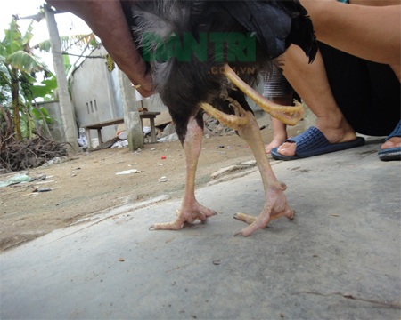 Đôi chân thừa mọc sát phía sau đôi chân chính