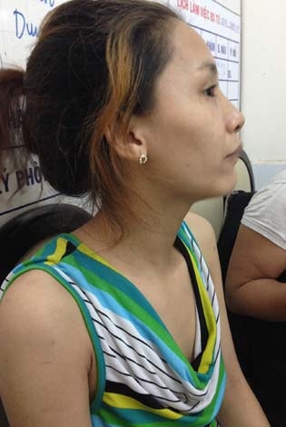 Đau lòng vụ bé gái 2 tuổi bị tạt hóa chất - 2 Chị
Ly đau đớn vì tình cảnh con gái gần như đã bị mù hai mắt.