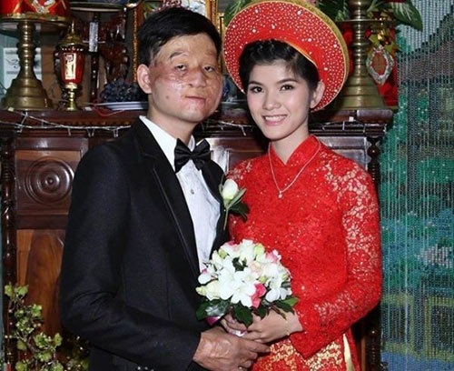 Những chuyện tình đẹp như “cổ tích thời hiện đại” - 3 Bức ảnh cưới từng nhận được nhiều sự quan tâm của cộng đồng mạng.