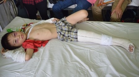  Bé Trần Văn Minh Hiếu đang điều trị tại Bệnh viện Chợ Rẫy