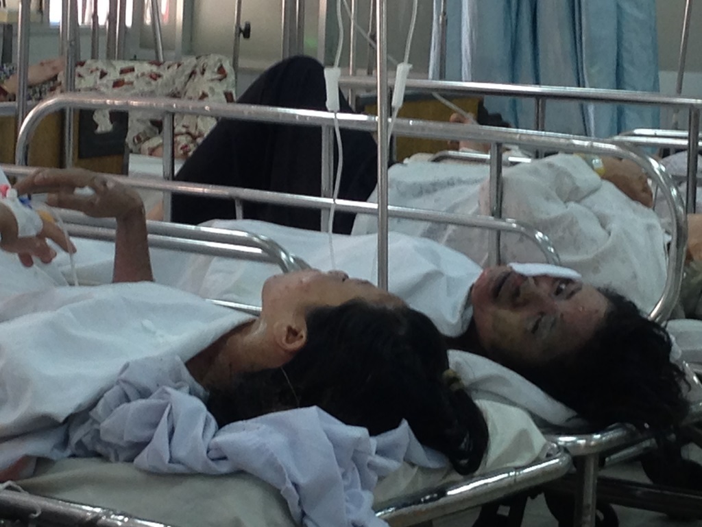 Vụ cháy khiến 2 người chết, 2 người đang cấp cứu tại Bệnh viện Chợ Rẫy