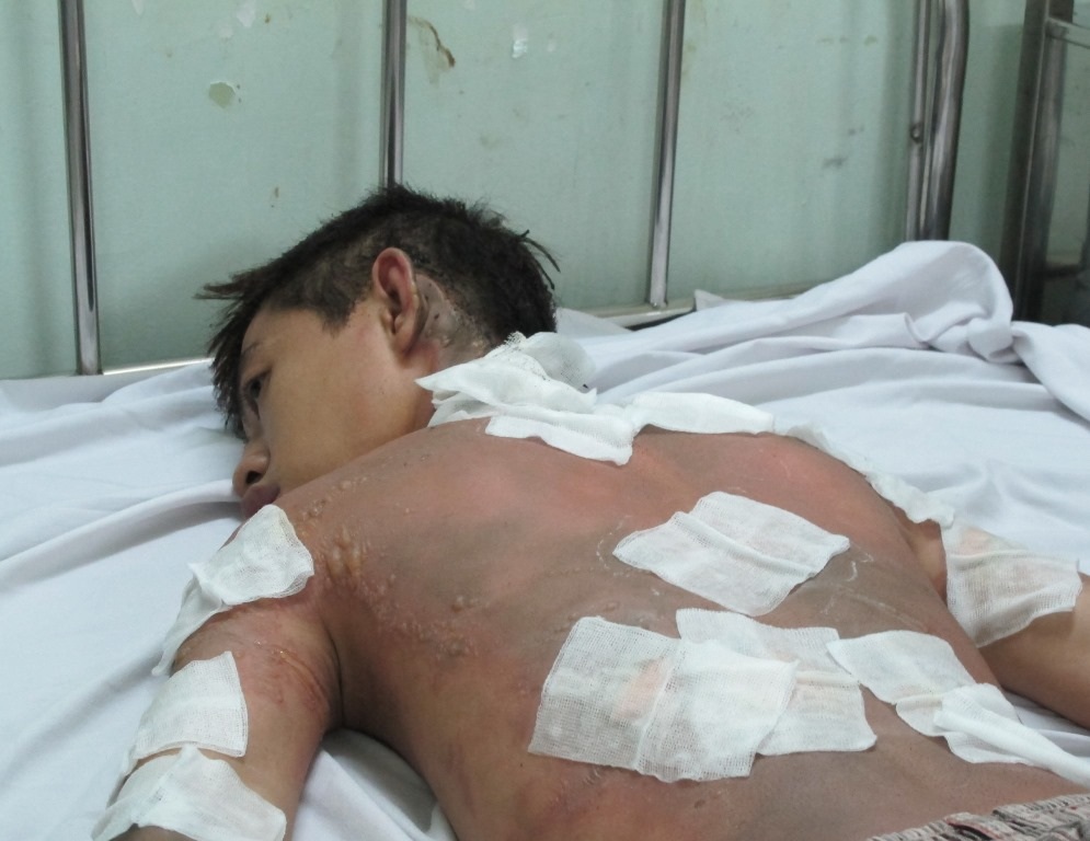 Em Nguyễn Phan Xuân Thiện đang cấp cứu tại bệnh viện Nhân dân 115