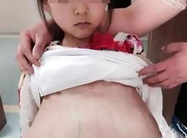 Bé 12 tuổi mang bầu được "chồng" đưa đến viện, khai báo là "cô vợ 20 tuổi" - 1
Cô bé được đưa đến viện bởi người đàn ông 40 tuổi và một người phụ nữ tự nhận là mẹ chồng của cô