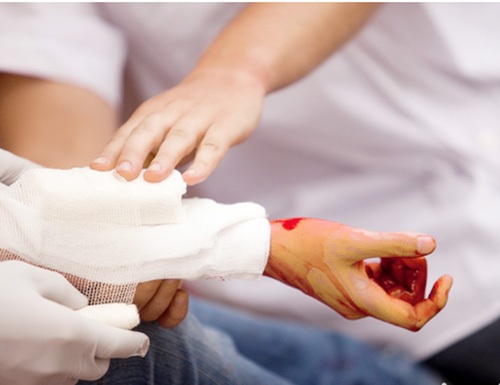 Cậu bé 10 tuổi đứt động mạch cánh tay vì va vào cửa kính trường học - 2
Việc sơ cứu với các vết thương gây mất nhiều máu trước khi chuyển bệnh nhân đến viện vô cùng quan trọng, quyết định sự sống của nguời bệnh.