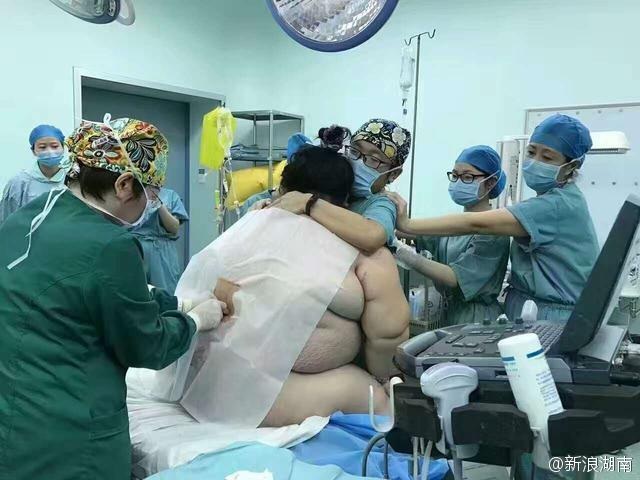 16 người loay hoay đỡ đẻ cho bà bầu "khổng lồ" 127 kg - 1 Bà bầu nặng 127 kg cần tới 16 người đỡ đẻ trong bệnh viện