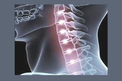 Đột biến lạnh có thể gây chứng vẹo cổ.