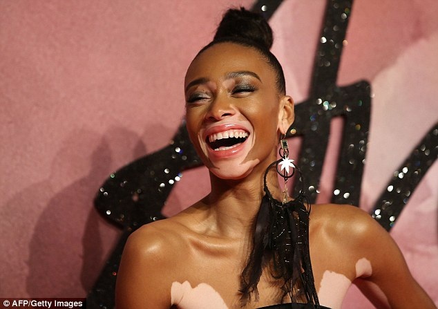 Váy xẻ táo bạo của người mẫu bạch tạng Winnie Harlow - 10 Váy xẻ táo bạo của người mẫu bạch tạng Winnie Harlow - 10