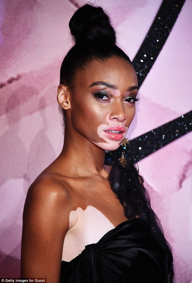 Váy xẻ táo bạo của người mẫu bạch tạng Winnie Harlow - 9 Váy xẻ táo bạo của người mẫu bạch tạng Winnie Harlow - 9