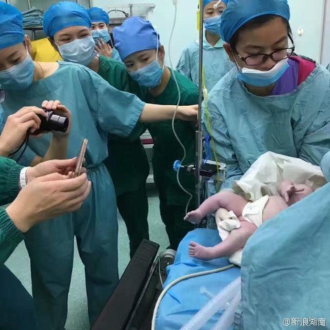 16 người loay hoay đỡ đẻ cho bà bầu "khổng lồ" 127 kg - 4 Thật may mắn, ca sinh đã thành công
