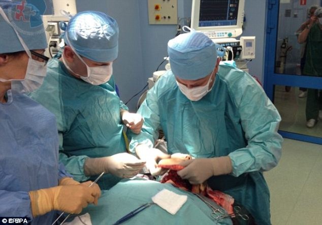 Các bác sĩ đang tách phần mặt bị biến dạng nặng do u xơ thần kinh – một bệnh di truyền gây ra những khối u lành tính dọc đường đi của dây thần kinh.