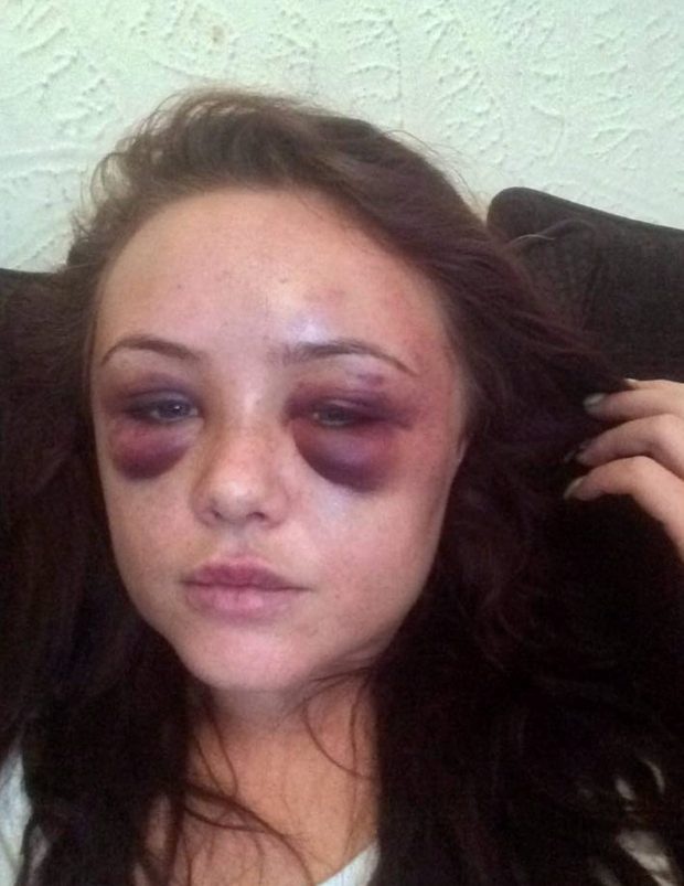 Võ sĩ đánh gãy răng và xương sườn bạn gái vì ghen - 4