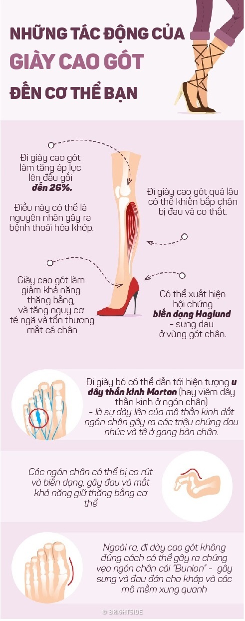 Đi giày cao gót đúng cách bảo vệ sức khỏe phụ nữ - 1 Đi giày cao gót đúng cách bảo vệ sức khỏe phụ nữ - 1
