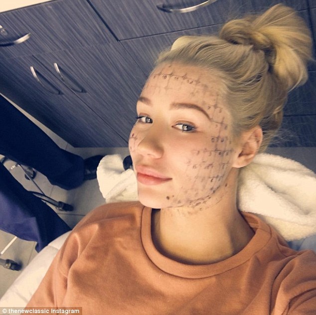 Ca sỹ 9X thay đổi quá nhiều sau phẫu thuật thẩm mỹ - 1
Iggy Azalea khoe ảnh đi chăm sóc da mặt bằng tia laser ngày 8/12 vừa qua. Vừa trải qua một số ca phẫu thuật thẩm mỹ làm đẹp, nữ ca sỹ người Úc giờ đây rất hài lòng với vẻ ngoài
