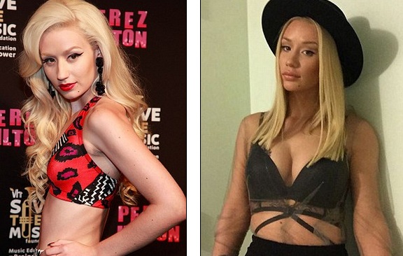 Ca sỹ 9X thay đổi quá nhiều sau phẫu thuật thẩm mỹ - 2
Fans không hiểu vì sao ca sỹ xinh đẹp Iggy Azalea lại cần thay đổi ngoại hình trong khi trước đây cô cũng đủ quyến rũ rồi....