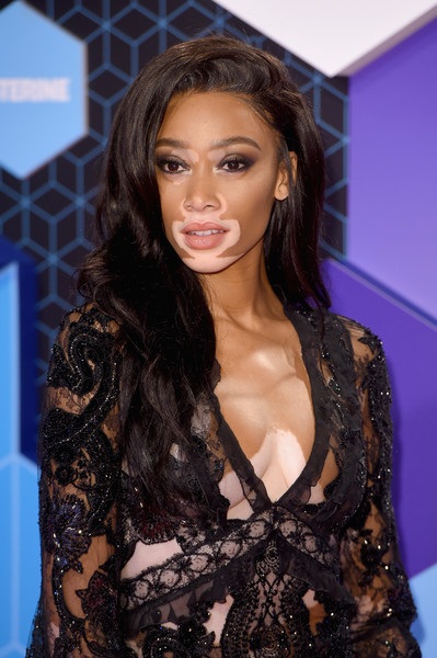 Siêu mẫu bạch tạng đọ dáng chân dài Anh quốc - 6
Cùng dự sự kiện còn có siêu mẫu Canada Winnie Harlow