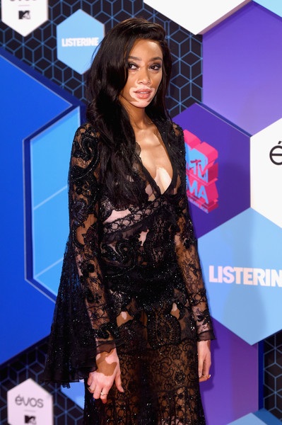 Siêu mẫu bạch tạng đọ dáng chân dài Anh quốc - 7
Winnie Harlow là trường hợp hiếm hoi trong làng mẫu thời trang